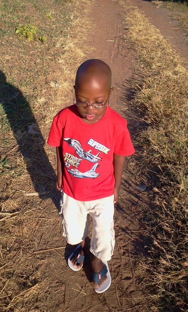 Supporting People with Down Syndrome in Africa