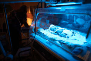 Jaundice treatment