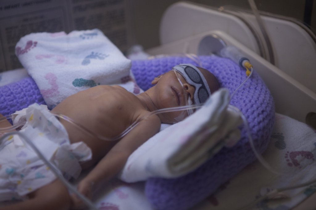 baby in neonatal
