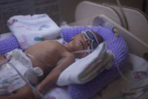 baby in neonatal