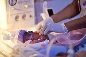 Baby receiving care on a CPAP machine