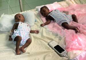 Twins treated for poor feeding and fever