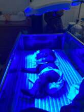 Baby receiving phototherapy treatment for jaundice