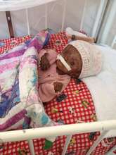 Baby Judeline as she battled on...