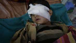 Pellet gun blinded more than a hundred...
