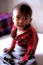 Malnourished Child