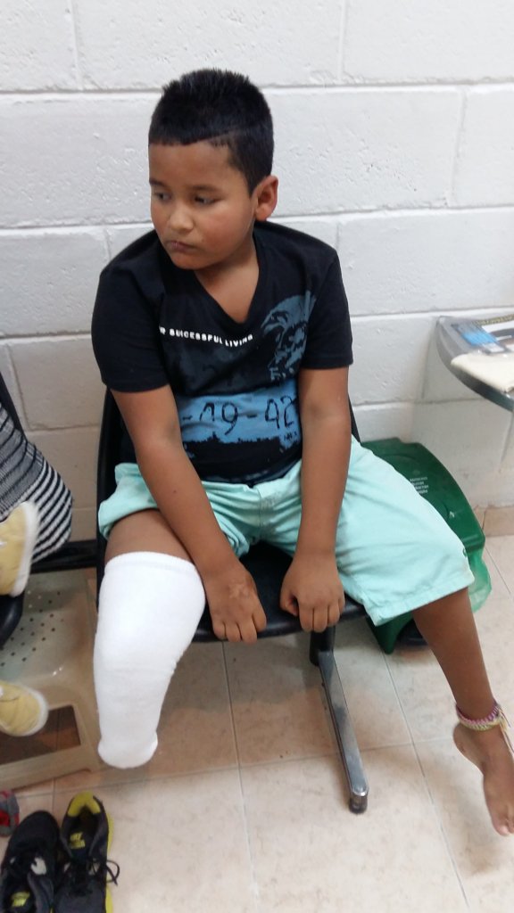 Help Juan have a prosthesis this christmas!!