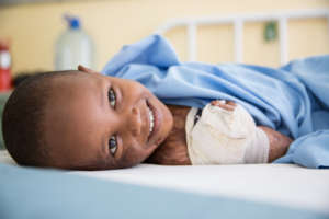 Children are often the victims of burn trauma