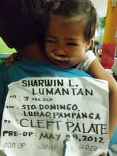 cleft palate screening
