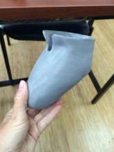 First custom 3D Printed prosthetic socket in Ecuad