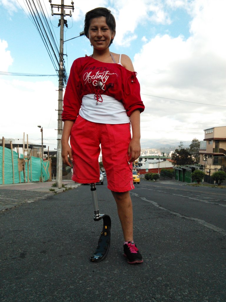 High-tech prosthetics for 75 Guatemalan amputees