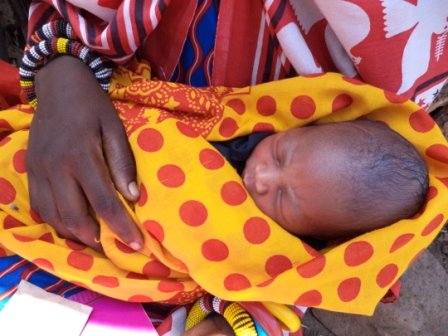 Vitamin A Deficiency Kenya