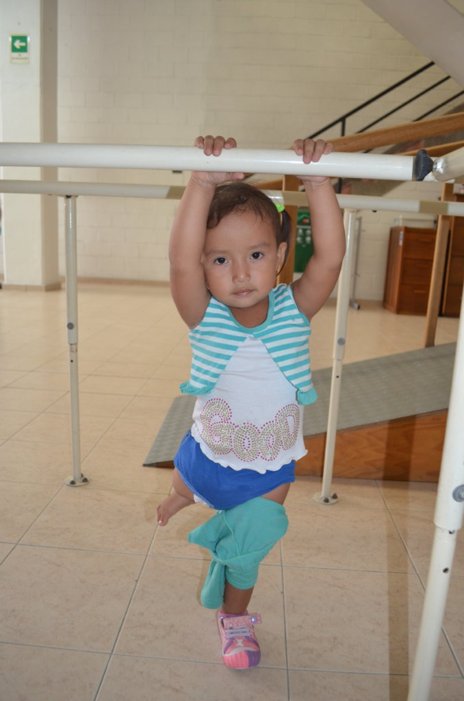 Salome needs a leg! Lets help her!