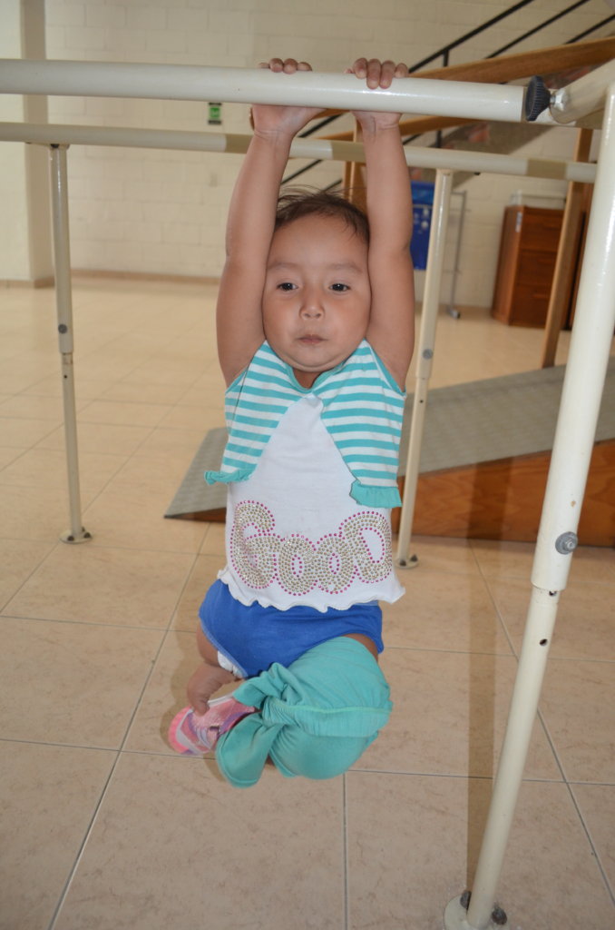 Salome needs a leg! Lets help her!