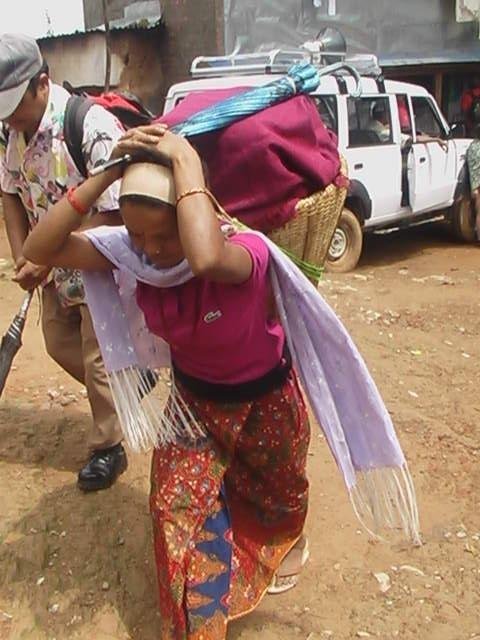 Addressing Uterine Prolapse in Rural Nepal