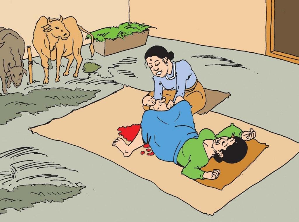 Addressing Uterine Prolapse in Rural Nepal