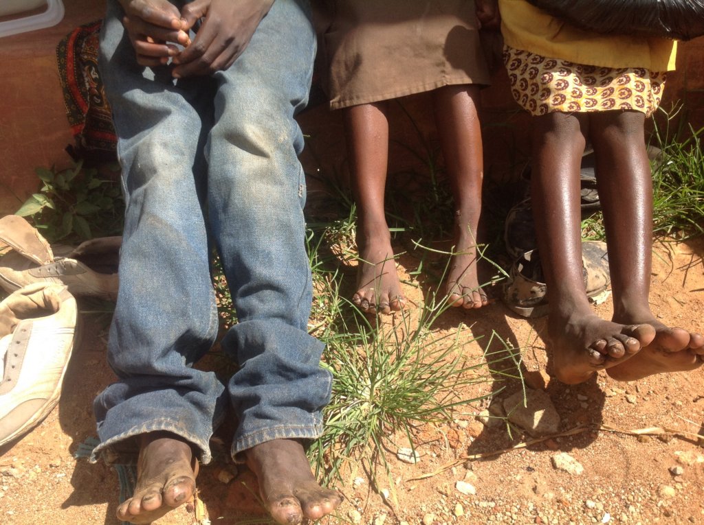 Eradicate Jiggers Among 500 Children in Bungoma - GlobalGiving