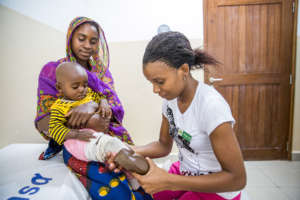 Patient receiving a prosthetic at CCBRT