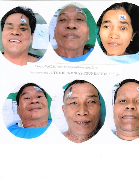 Cambodian cataract patients