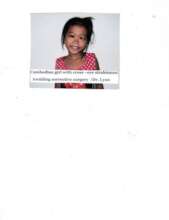 Young girl with cross-eyes awaiting surgery repair