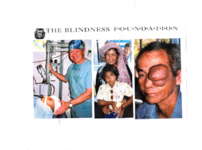 Donated operating microscope, Tumour patient ,kids