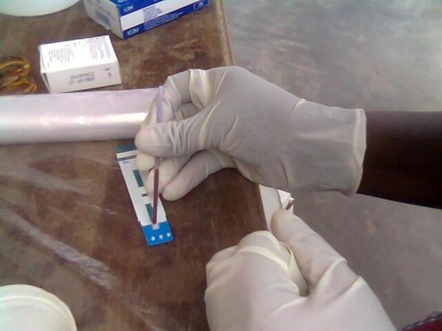 HIV services in primary health care