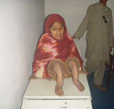 PWD woman