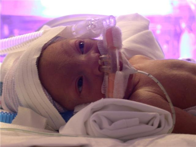 Our Tiny Ones In Our NICU...