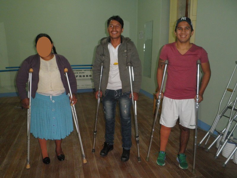 Fifty prosthetic limbs for Low Income amputees
