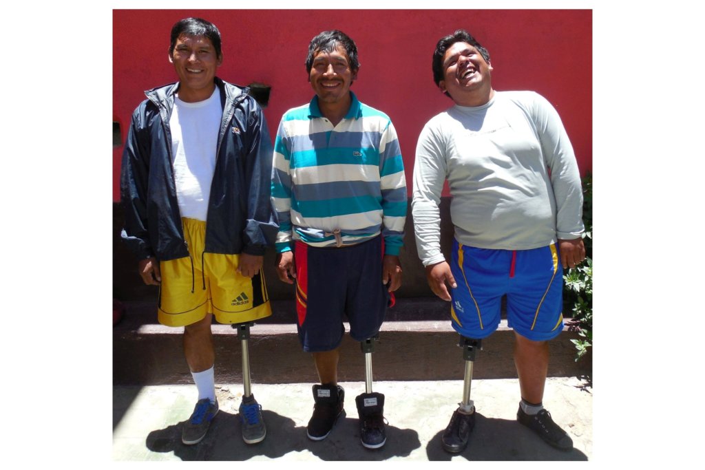 Fifty prosthetic limbs for Low Income amputees