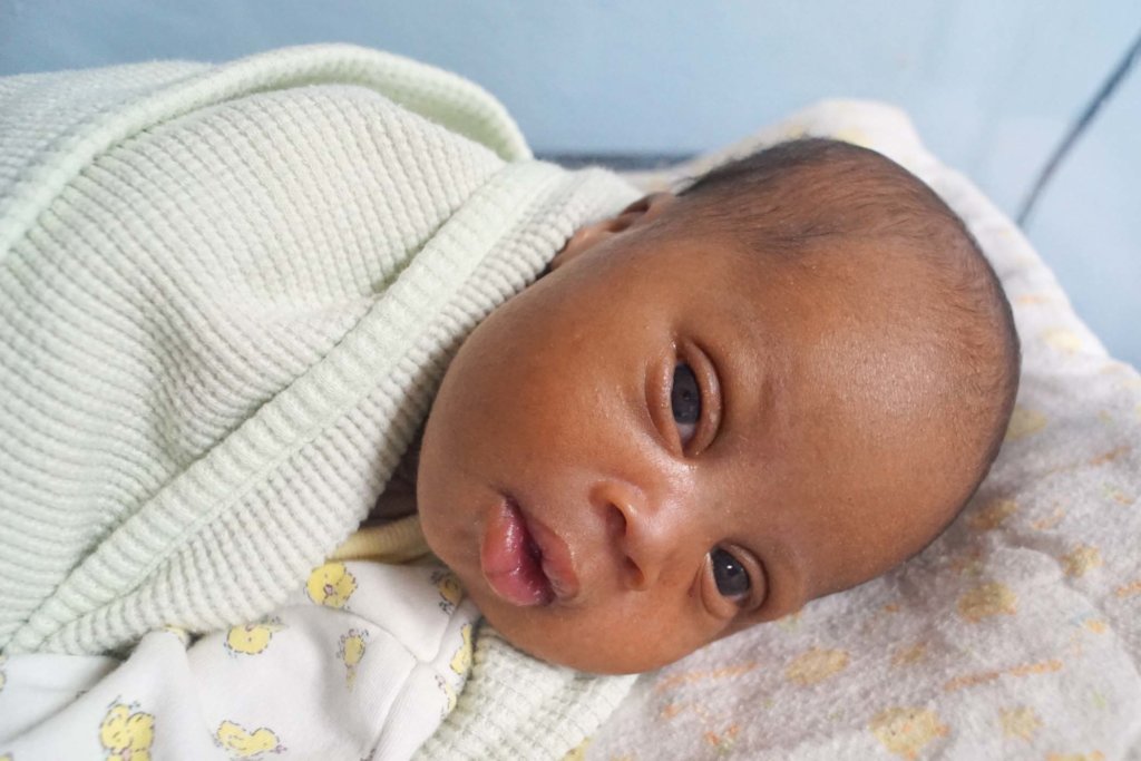 Baby B with Down's Syndrome