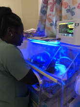 Baby Neila receiving phototherapy for jaundice