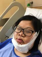 Young Member after Surgery