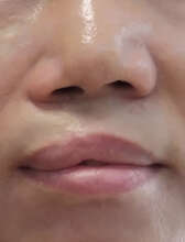 Patient seeking for help