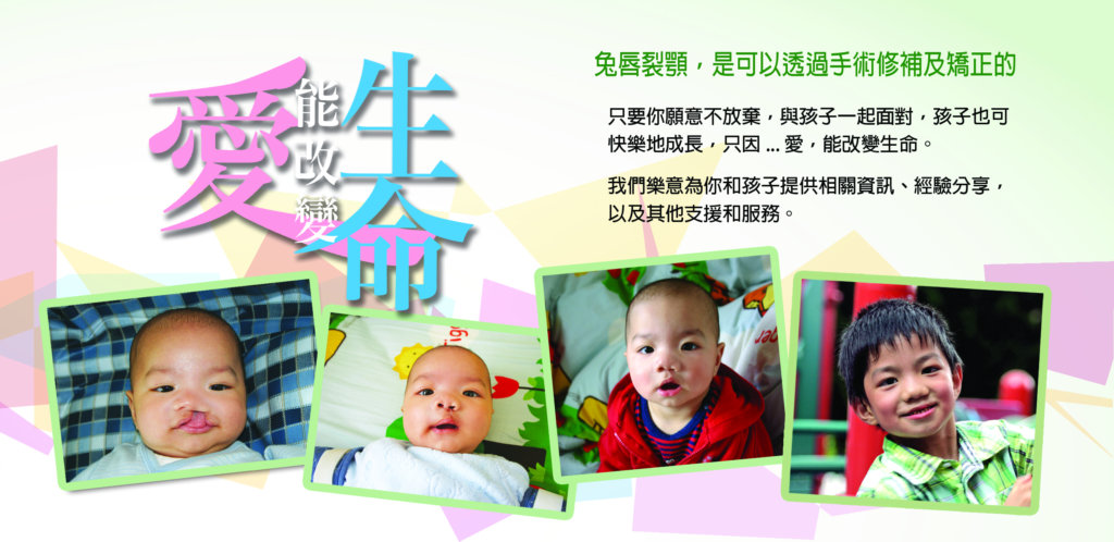 Give HK Cleft Lip and Palate Families a Smile