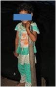 Reduce Malnutrition & Death of 2000 Tribal People