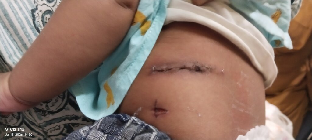 A little Fighter's Journey to Recovery