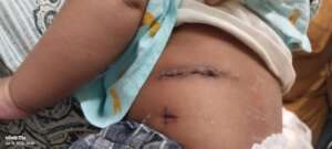 A little Fighter's Journey to Recovery