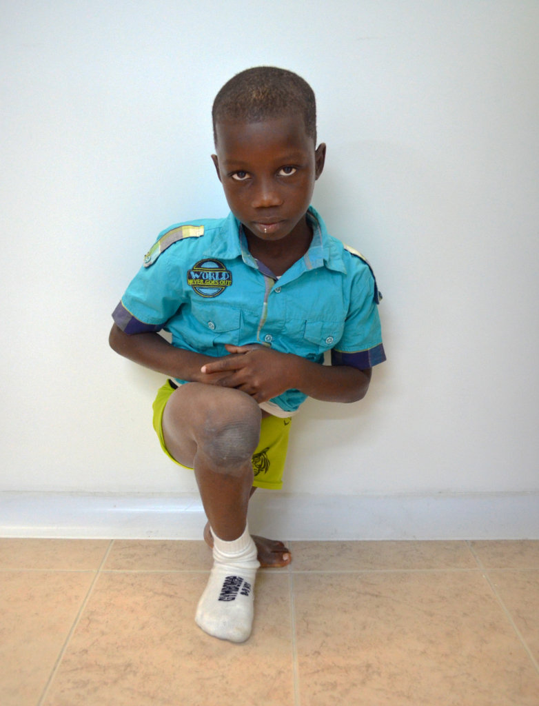 Ever needs your help to walk again