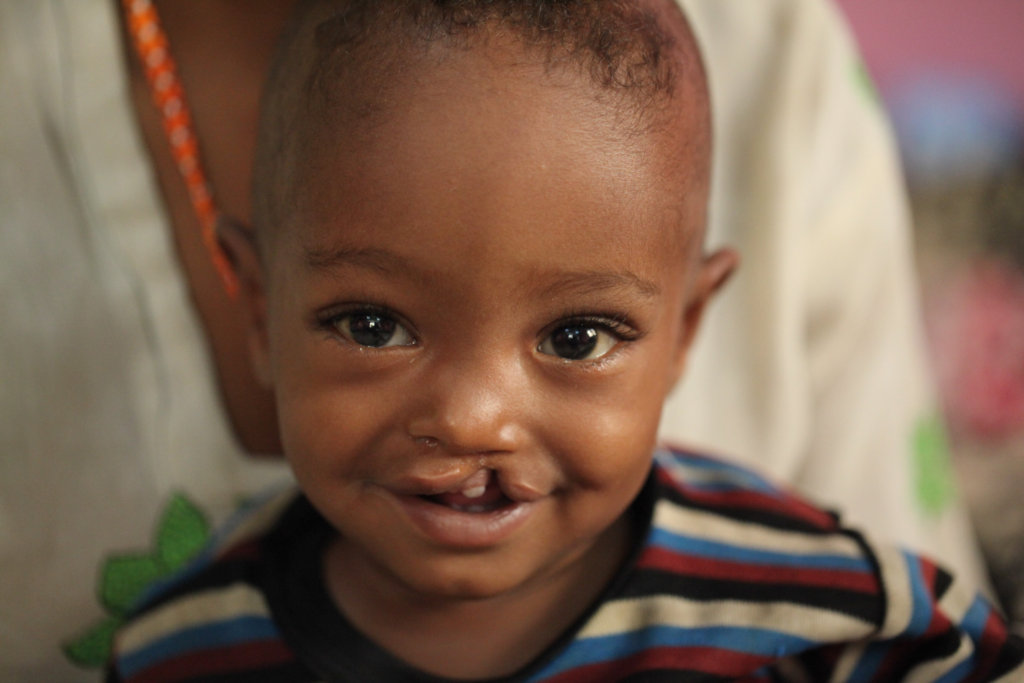Train Ethiopian Health Workers in Nutrition