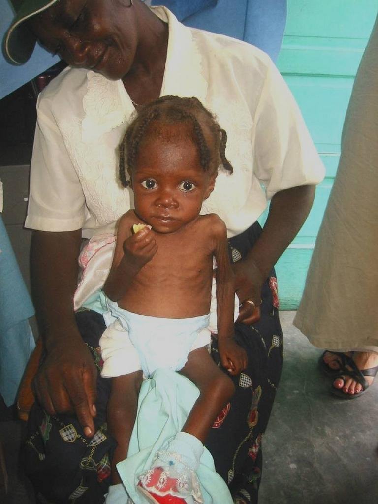 Childhood Malnutrition in post-earthquake Haiti