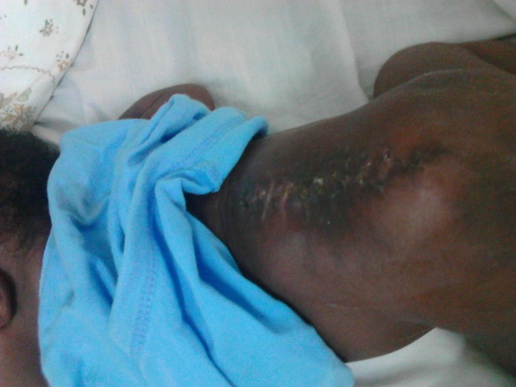 Help treat I'll baby in Uganda