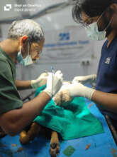 5kg tumor removed surgically
