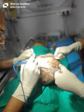 Dog with a 5kg tumor recovered after surgery
