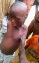 Sani - survivor and orphan of Boko Haram attacks.