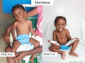 Chrislene at arrival and after months of treatment