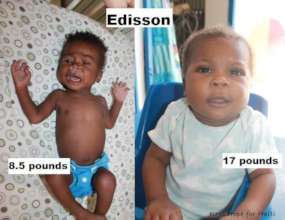 Edisson, before & after