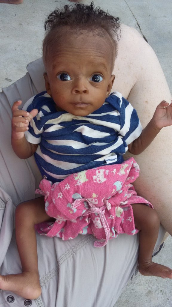 Helping Babies in Haiti