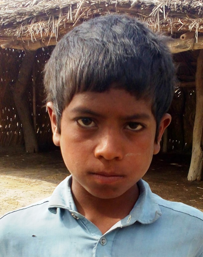 Reports on Bringing Quality of Life to Adopted Orphan Child - GlobalGiving