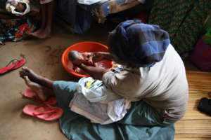 Mother washing infant at Kachumbala Clinic, Uganda
